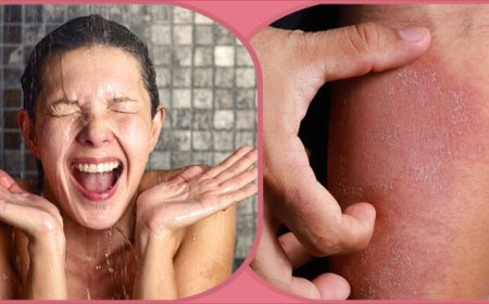 শীতে গোসলের ভুলে চুলকানি হচ্ছে না তো?